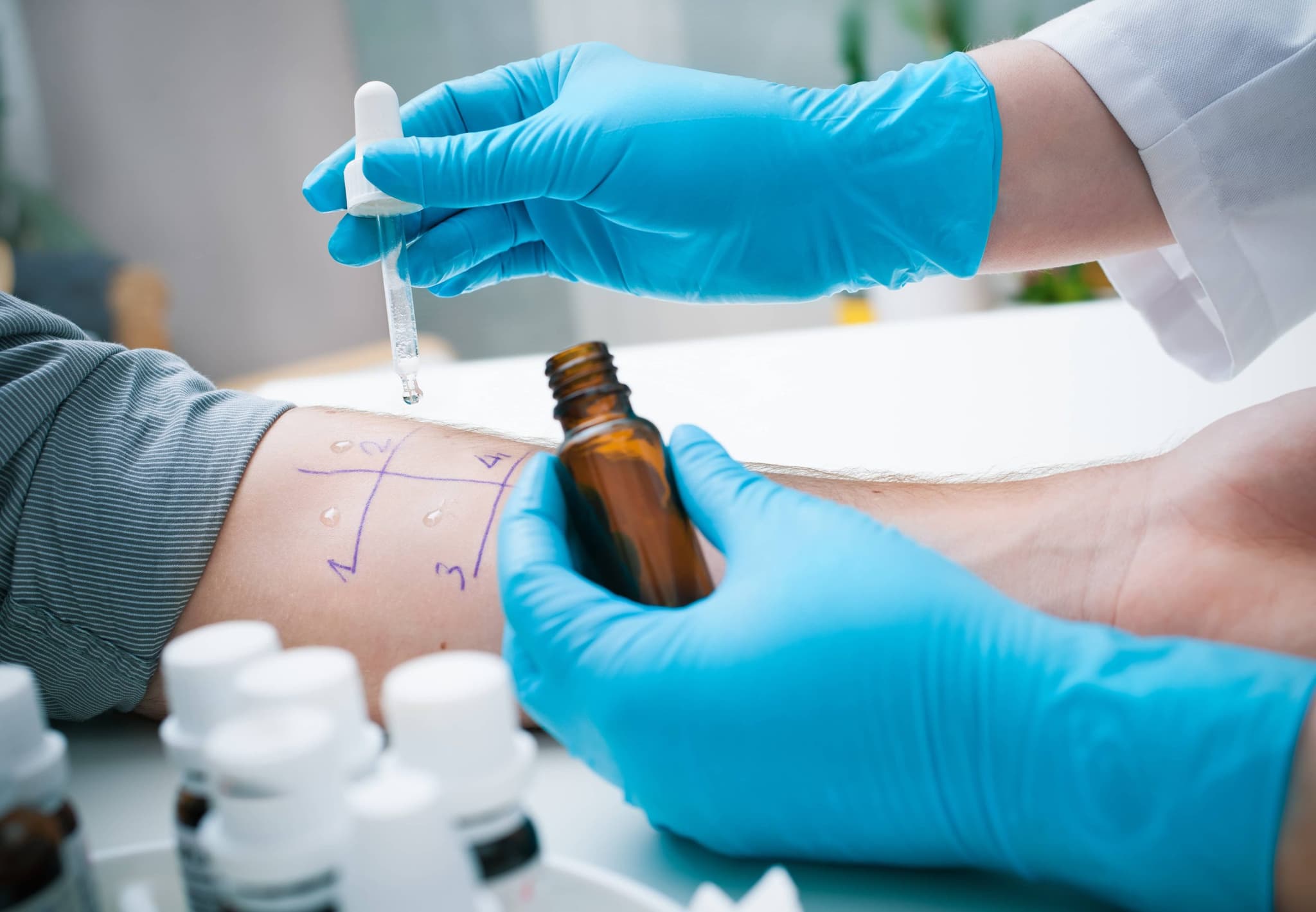 Image of Testing for allergies can greatly improve you quality of life, learn today how you can prepare for a testing appointment!